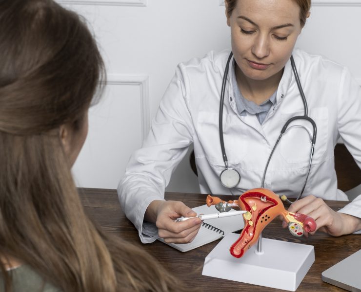 ovarian syndrome naturopatia