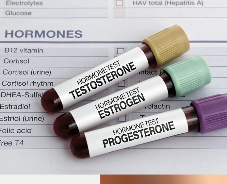 hormone-replacement-therapy-london